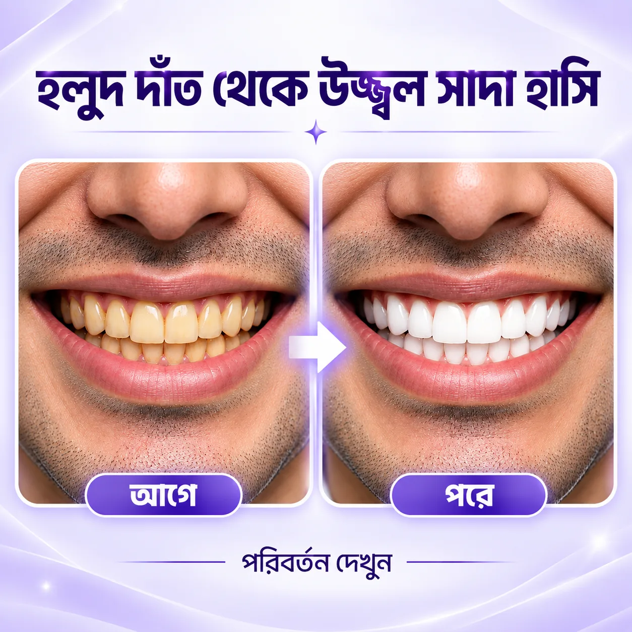 LANEMAY ব্যবহারের আগে ও পরের হাসি